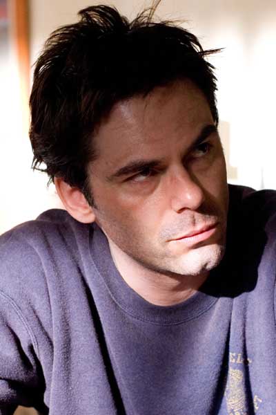 Billy Burke Fracture