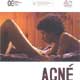 Acné cartel reducido